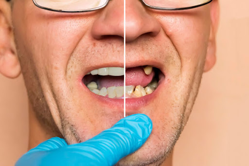Your #1 dentist and restorative dentistry treatments provider in Matthews, near Charlotte, NC