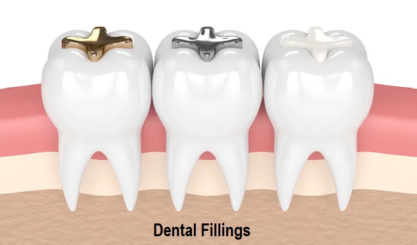 Dermal fillers and lip fillers in Matthews, NC, for natural-looking facial restoration.