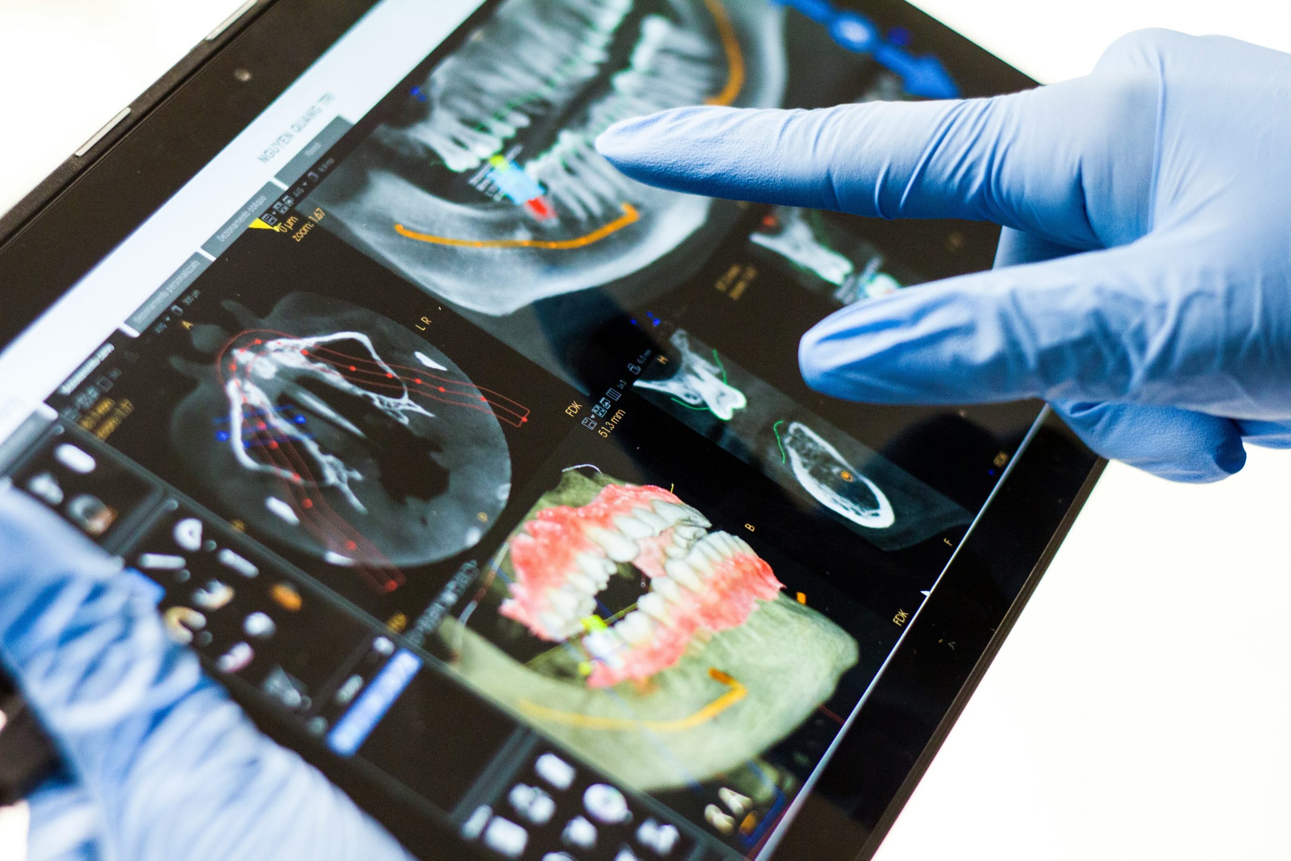 Dental X-Rays in Matthews near Charlotte, NC.